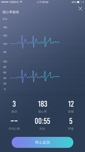 朵尔监护app截图4