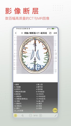 3Dbody解剖app截图4